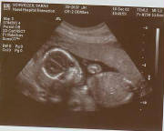 19weeks4days.jpg