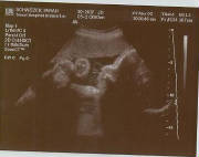 32weeks.jpg