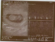 9weeks5days.jpg